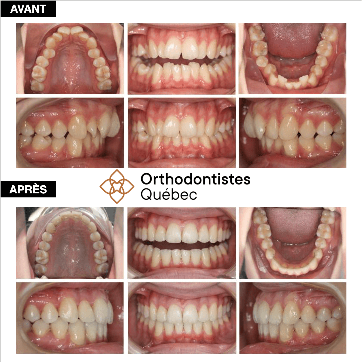 Documentation Information aux clients Orthodontistes Québec
